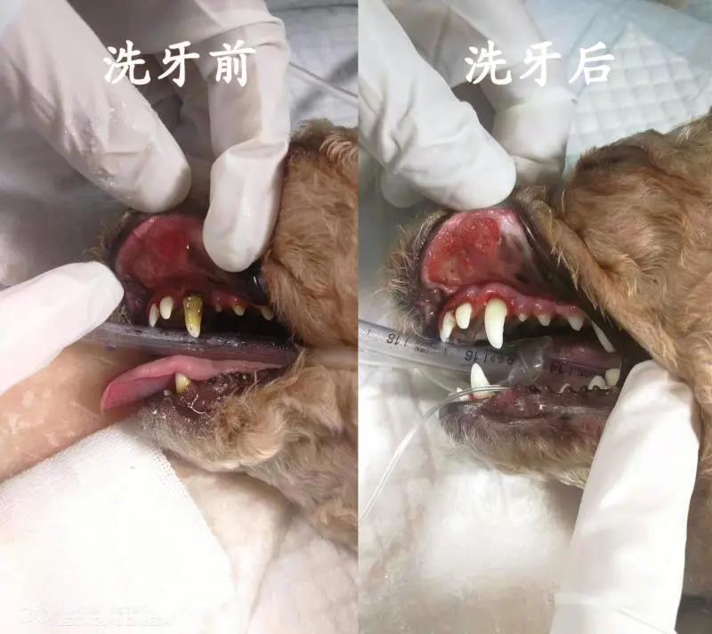 洗牙對(duì)比圖